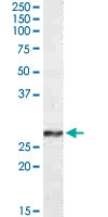 PAB14140 - Complex I subunit NDUFS3