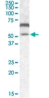 PAB14145 - CAMK2A