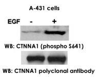 PAB14159 - Catenin alpha-1 / CTNNA1