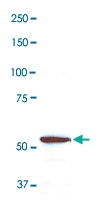 PAB14169 - Coronin-1A