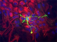 PAB14169 - Coronin-1A
