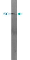 PAB14170 - Neurofilament H (200 kD)