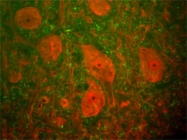 PAB14170 - Neurofilament H (200 kD)