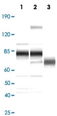 PAB14292 - Herpes Virus Type 8 / HHV8