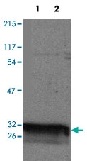 PAB14303 - 14-3-3 protein theta