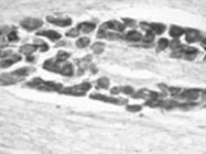 PAB14311 - BDNF