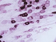 PAB14319 - TRPV2 / VRL1