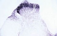PAB14319 - TRPV2 / VRL1