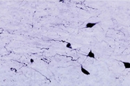 PAB14322 - Orexin receptor type 1