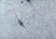 PAB14325 - Dopamine beta-hydroxylase