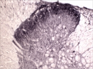 PAB14332 - TrkA