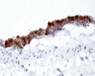 PAB14334 - AP1 complex subunit gamma-1 / AP1G1