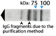 PAB14335 - AP1 complex subunit beta-1 / AP1B1