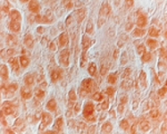 PAB14337 - NGF