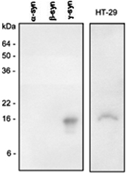 PAB1627 - Gamma-Synuclein / SNCG