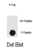 PAB1636 - DNA-PKcs / PRKDC / XRCC7