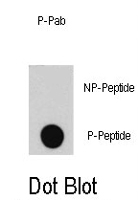 PAB1637 - E2F1
