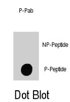 PAB1640 - Integrin-linked protein kinase