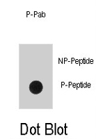 PAB1663 - EGFR / ERBB1