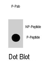 PAB1672 - CDKN1A / p21WAF1