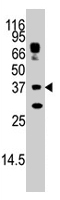 PAB1693 - STUB1 / CHIP