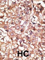 PAB1693 - STUB1 / CHIP