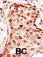 PAB1697 - CBLC / RNF57