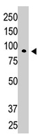 PAB1698 - CBLC / RNF57