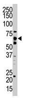 PAB1699 - Ubiquilin-2 (UBQLN2)