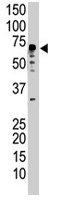 PAB1700 - Ubiquilin-2 (UBQLN2)