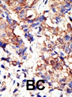 PAB1700 - Ubiquilin-2 (UBQLN2)