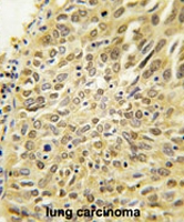 PAB1700 - Ubiquilin-2 (UBQLN2)