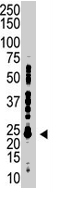 PAB1701 - UBE2S
