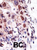 PAB1702 - UBE2S