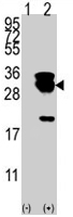 PAB1702 - UBE2S