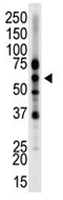 PAB1710 - Epsin-2