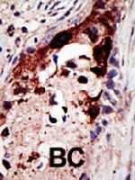 PAB1710 - Epsin-2