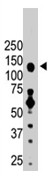 PAB1714 - HDAC6