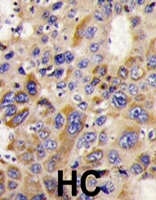 PAB1714 - HDAC6