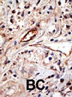 PAB1719 - ISG15 / G1P2