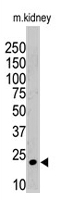 PAB1720 - ISG15 / G1P2