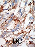 PAB1720 - ISG15 / G1P2
