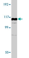 PAB1726 - MIB1