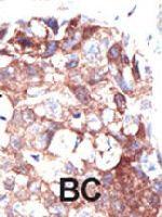 PAB1740 - Ubiquilin-1 (UBQLN1)