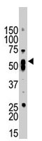 PAB1751 - STAM1