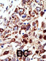PAB1751 - STAM1