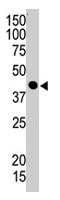 PAB1758 - TSG101