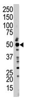 PAB1759 - TSG101