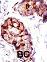 PAB1759 - TSG101