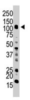 PAB1772 - UBE1 / UBA1